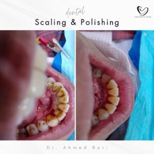best dentist in karachi Best Children Hospital
