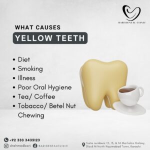 dentist north nazimabad Best plague cleaning 